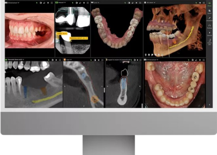 DTX-Studio-Clinic_Screen_With_Images.png-removebg-preview