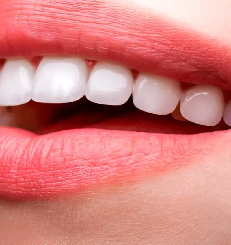 Top-rated teeth whitening dentist
